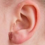 descamación de las orejas